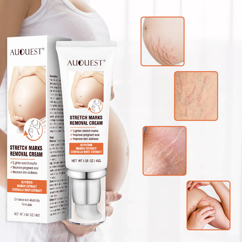 Remove Pregnancy Scars Acne Cream Stretch Mark